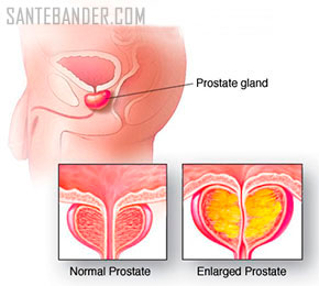 Traitement de l’HBP