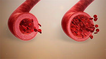 vasodilatatrices et hypotensives